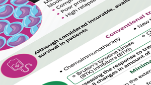 Infographic MCL Diagnosis and Treatment